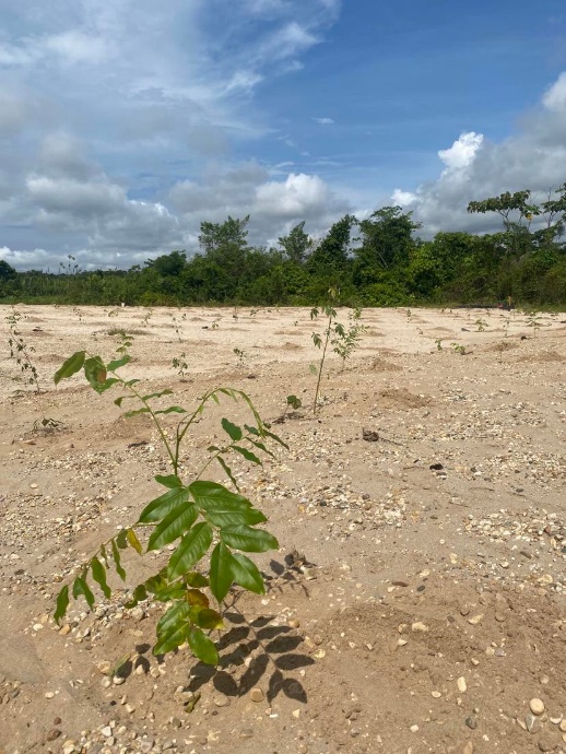 Child's hands and feet deformed by mercury poisoning from gold mining in Amazon