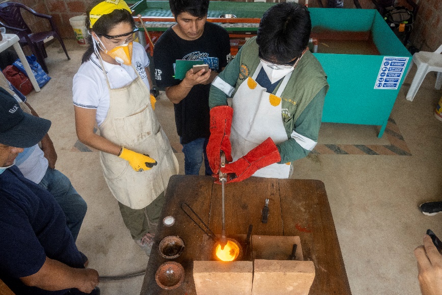 Child's hands and feet deformed by mercury poisoning from gold mining in Amazon